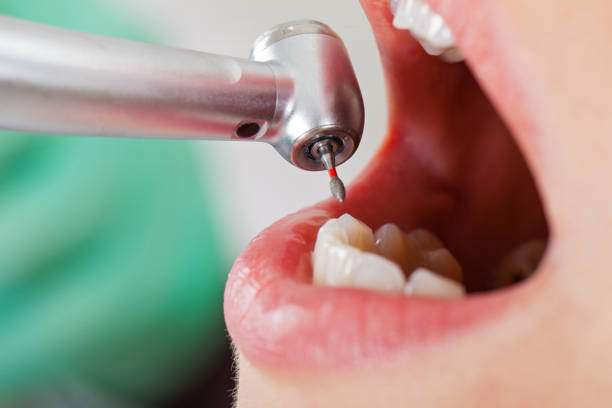 Best Pediatric Emergency Dentist in Roxborough Park, CO